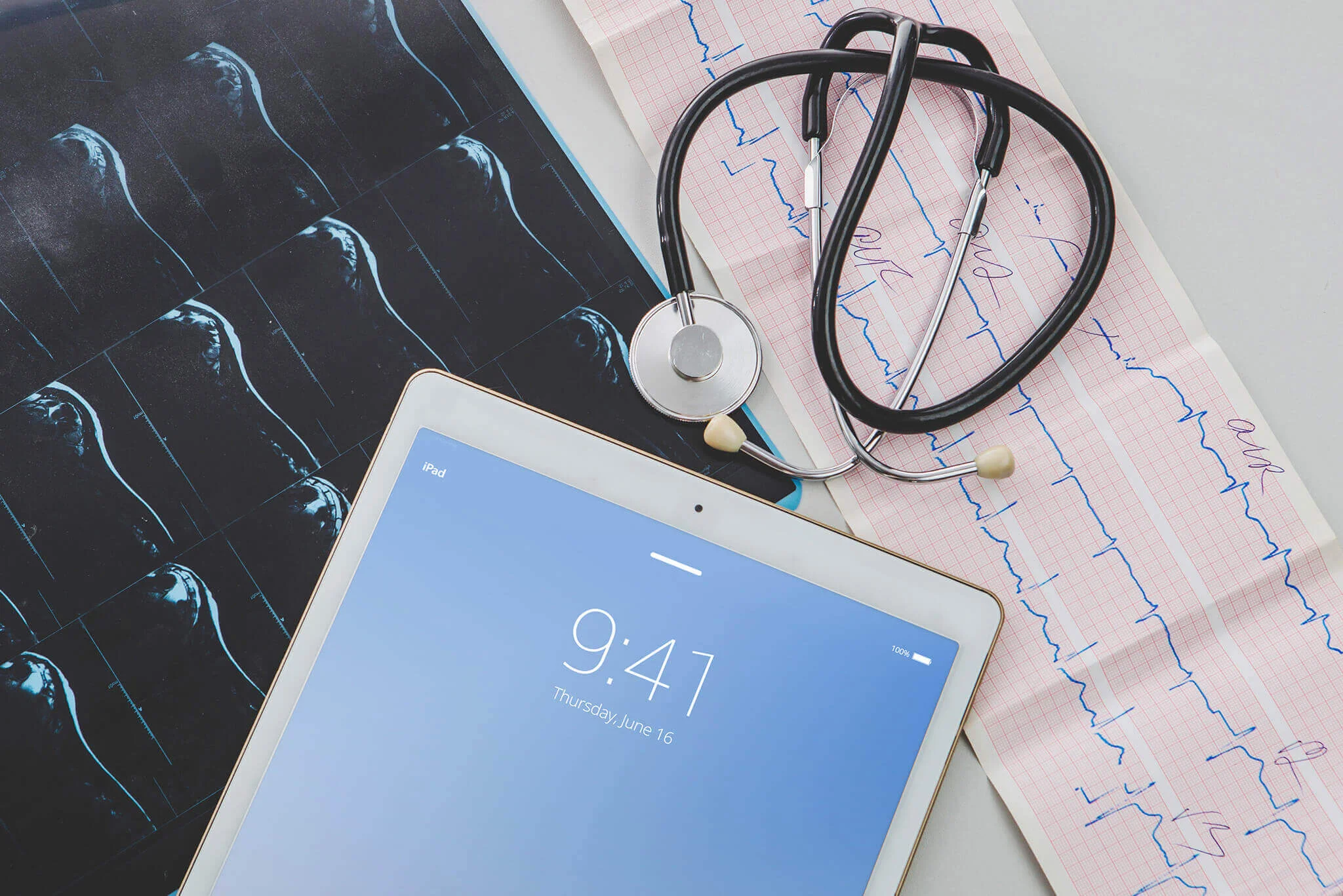 ECG diagnostic test
