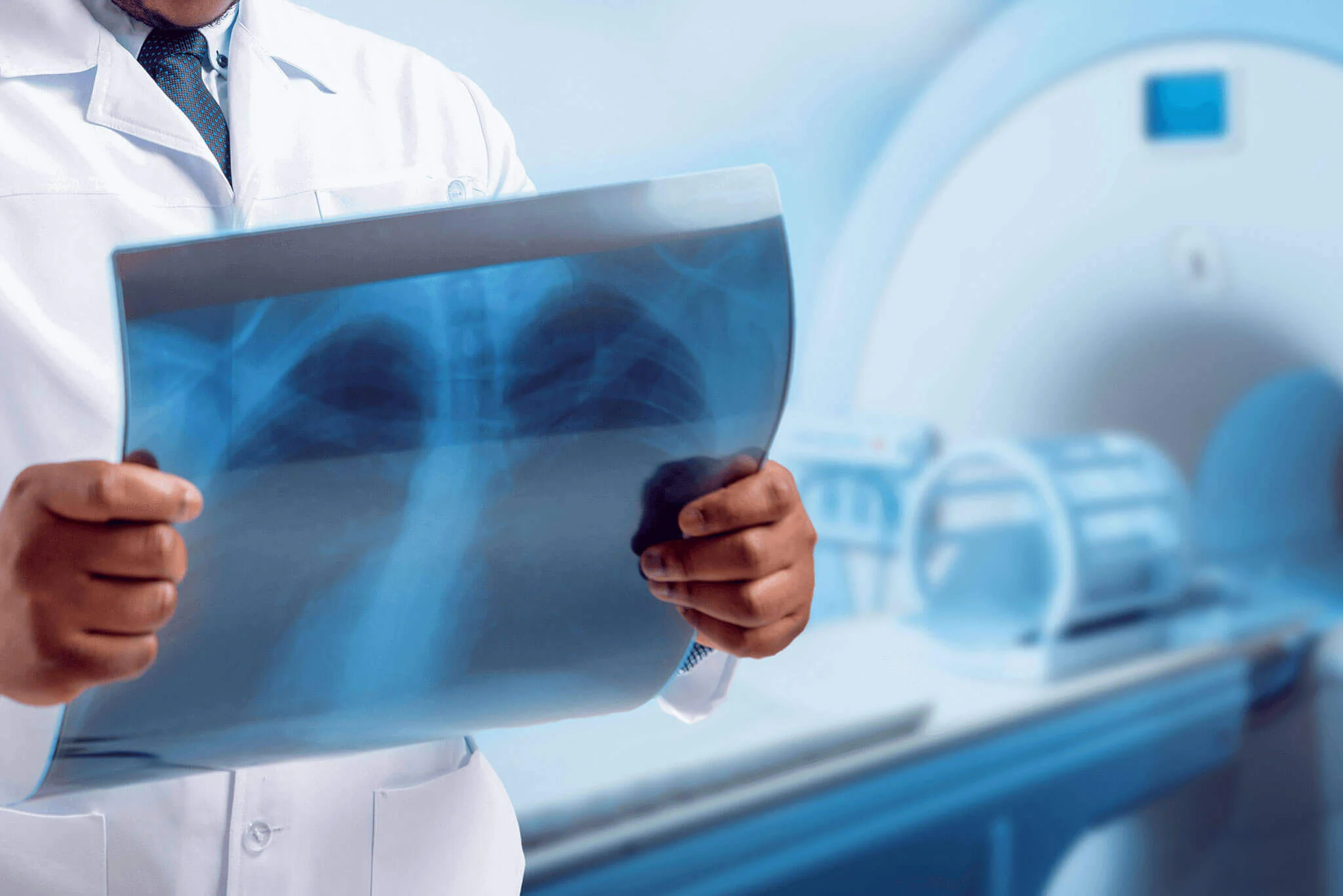 Digital X-ray imaging equipment